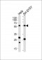 CALR Antibody